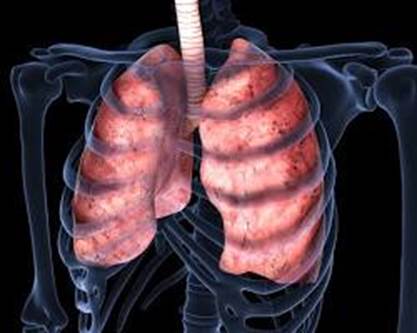 malattia polmonare
