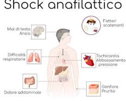 shock anafilattico